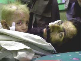 ABD, Afganistan'da Hırçınlaştı