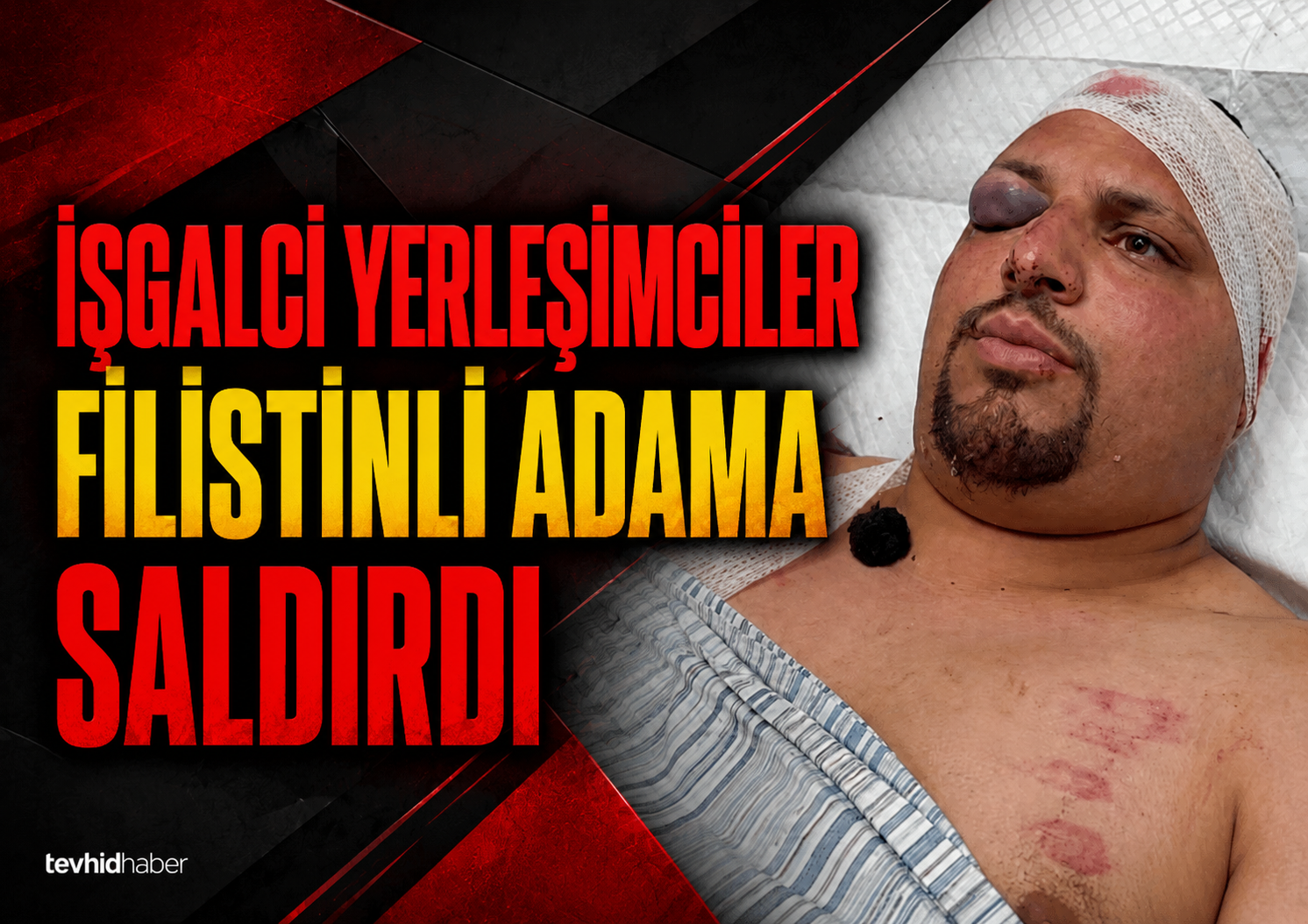 Filistinlilere önce ateş sonra baltalarla saldırı!