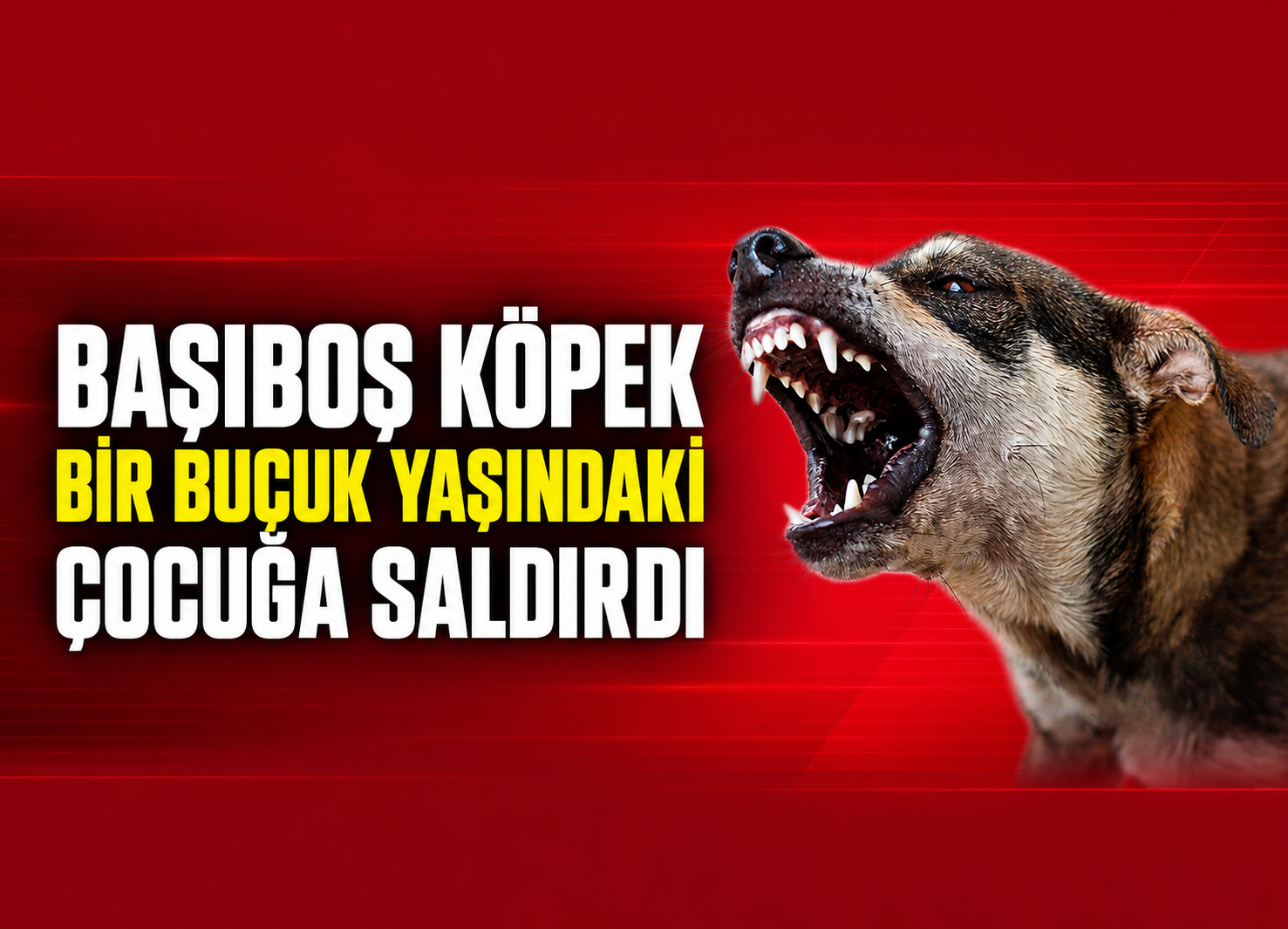 Başıboş köpek bir buçuk yaşındaki çocuğa saldırdı