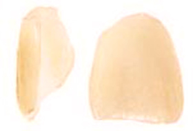 İran Doku Yapıştırıcısı Geliştirdi